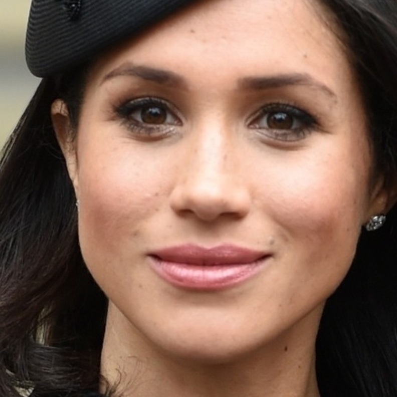 ميغان ماركل وعمليات التجميل 2018