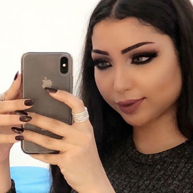 انتفاخ وجه دنيا بطمة وعاصي الحلاني