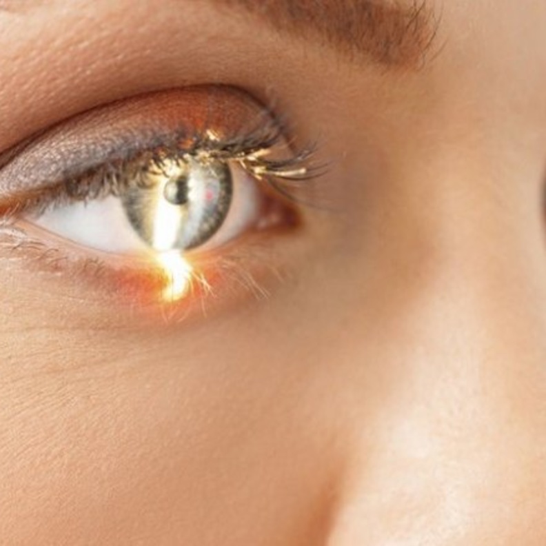 عمليات تصحيح البصر تختلف حسب نسبة نجاحها