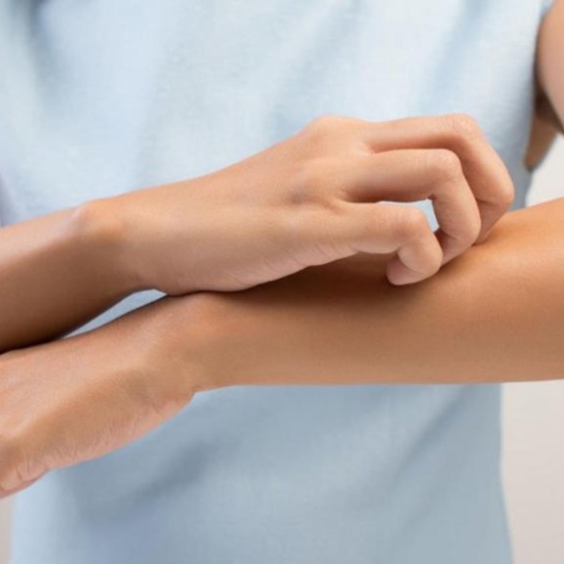 الكبريت يسبب الطفح الجلدي