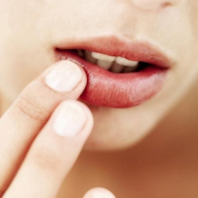 تراجع الثة من مضاعفات الالتهابات البكتيريرة