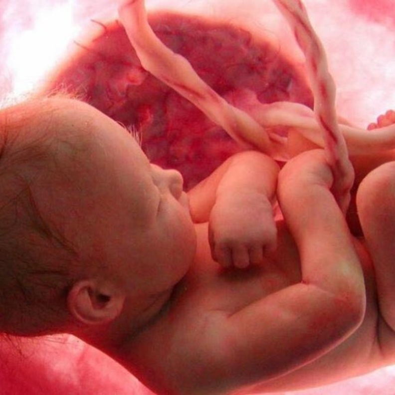 موت الجنين في رحم الام .. ما هي اسبابه ومخاطره