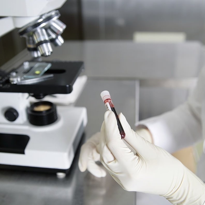 تحاليل الدم تختلف بإختلاف النتائج