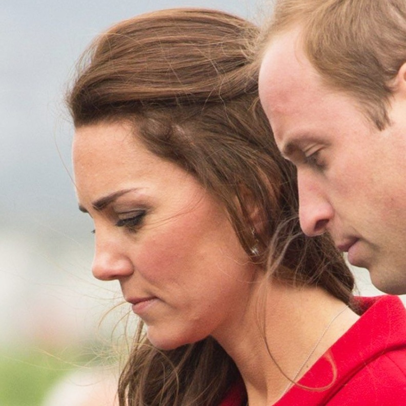 ما سر الندبة الصغيرة التي توجد على رأس كيت ميدلتون؟