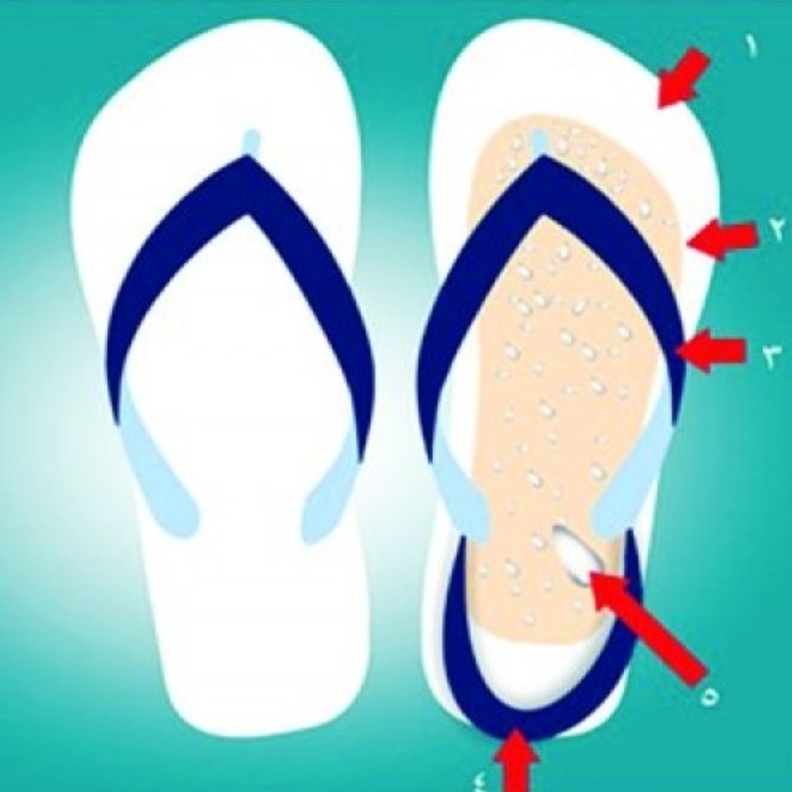 يلامس الحذاء باطن القدم في أثناء المشي