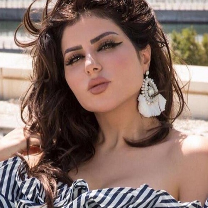 حليمة بولند أجرت مؤخرا عملية تكساس لفكها