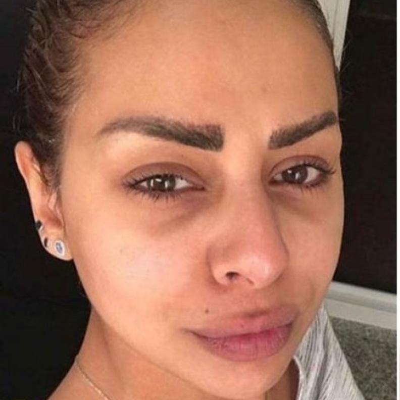 هند البلوشي تصاب بمرض يحير الاطباء