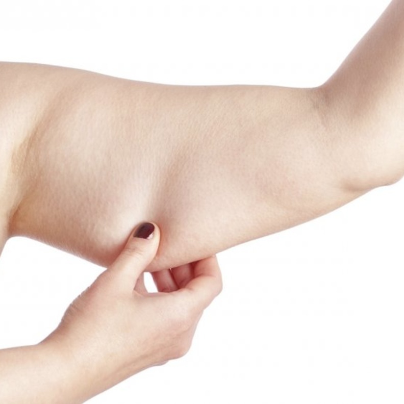  التخلص من دهون الذراعين