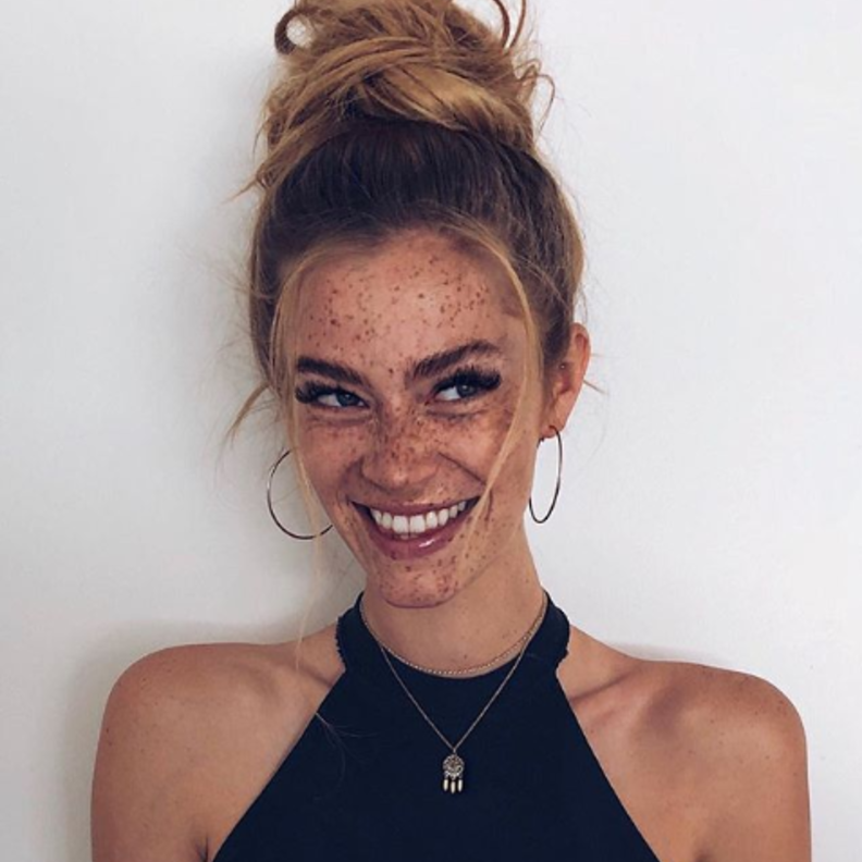 سوانتى بولينا تلقب بملكة جمال النمش