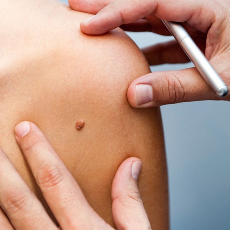 يختلف نوع الثالول حسب مكان الإصابة