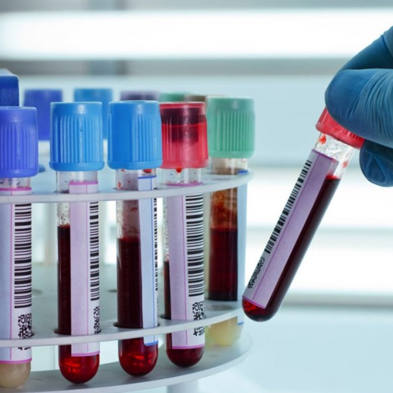 فقر الدم الحديث هو نقص فيتامين ب12