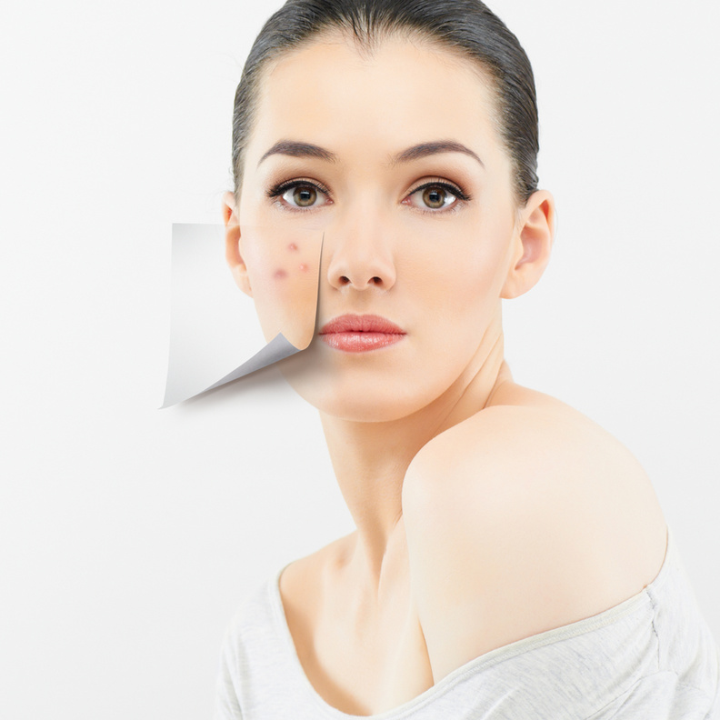 تعرفي على طرق علاج حب الشباب بماء الورد