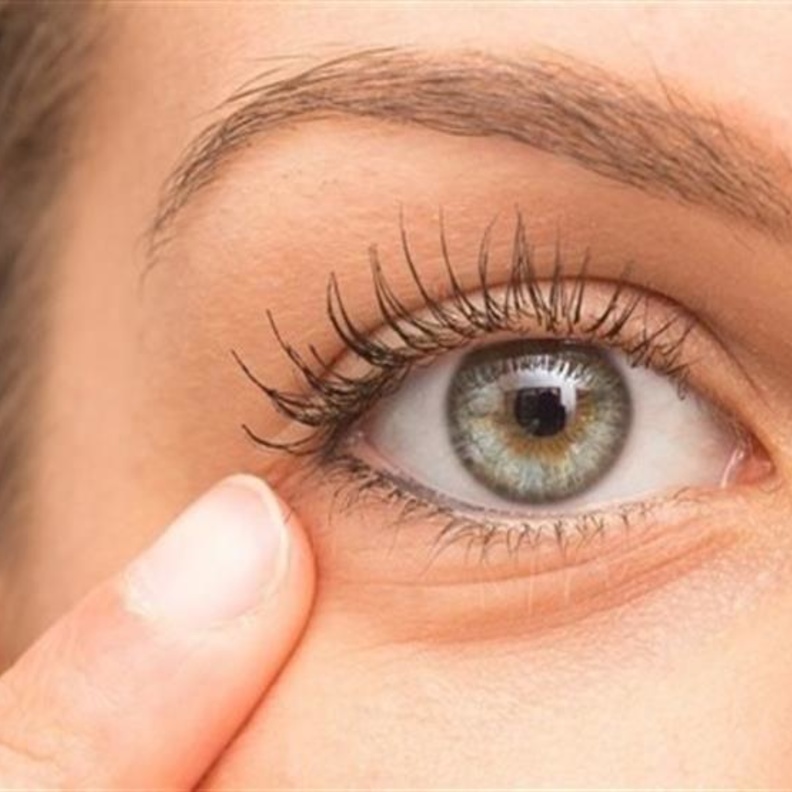 تورم العيون من أعراض الالتهابات