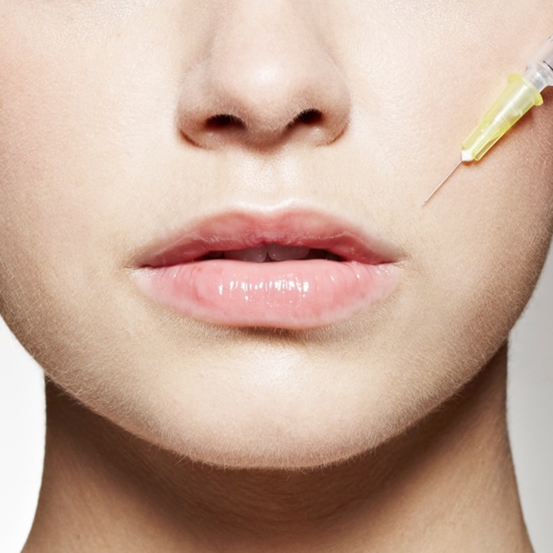 هل حقن الفيلر مؤلمة ؟