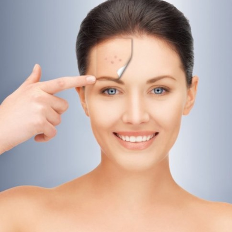 لا تتناسب جلسات تقشير البشرة بالليزر مع البشرة الداكنة