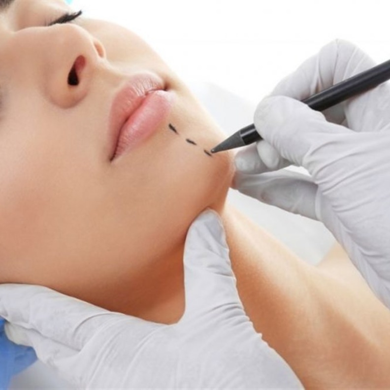 كيف تتم عملية تصغير الذقن؟