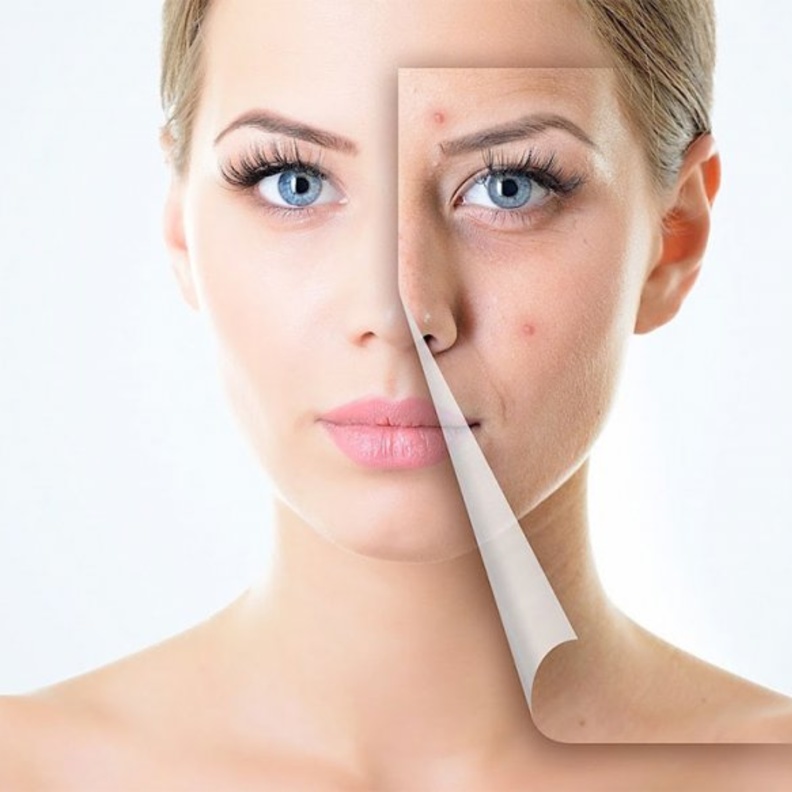 اهم فوائد واضرار عسل الشفلح للبشرة