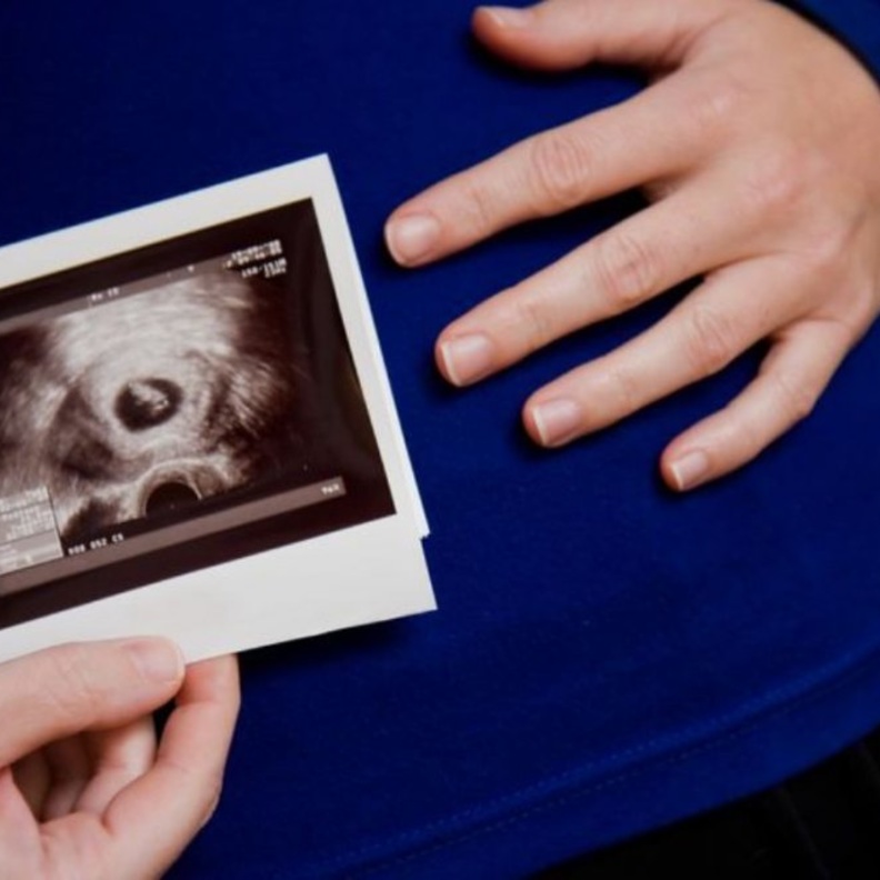 أعراض الحمل بولد في الشهر الثالث