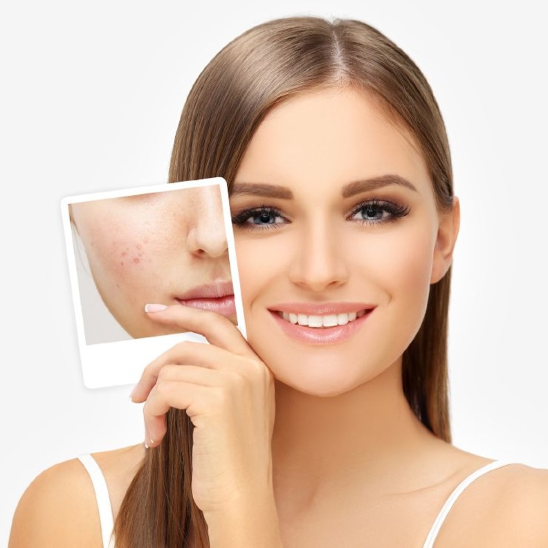 فوائد خل التفاح للعناية بالجسم والبشرة