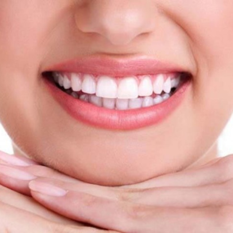 الابتسامة اللثوية لها تأثير سلبي على جمالية ابتسامتك