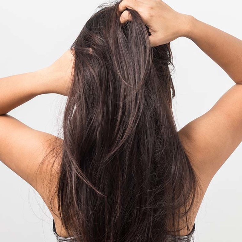 ارتدي اللون الاسود من جديد وبلا قلق، القشرة لها حلول