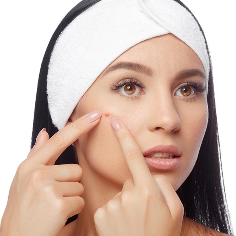 ابتعدي عن الادوية لعلاج حب الشباب