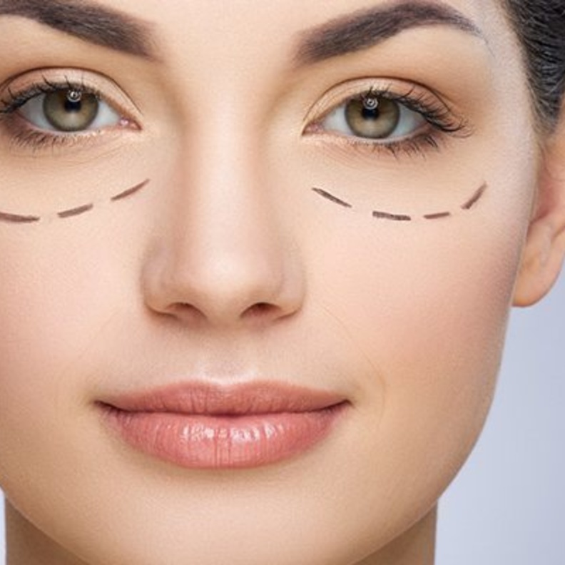  كيفية التخلص من انتفاخ تحت العين بالليزر