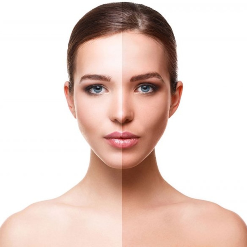 غيري لون جلدك بمساعدة فراكشنال ليزر