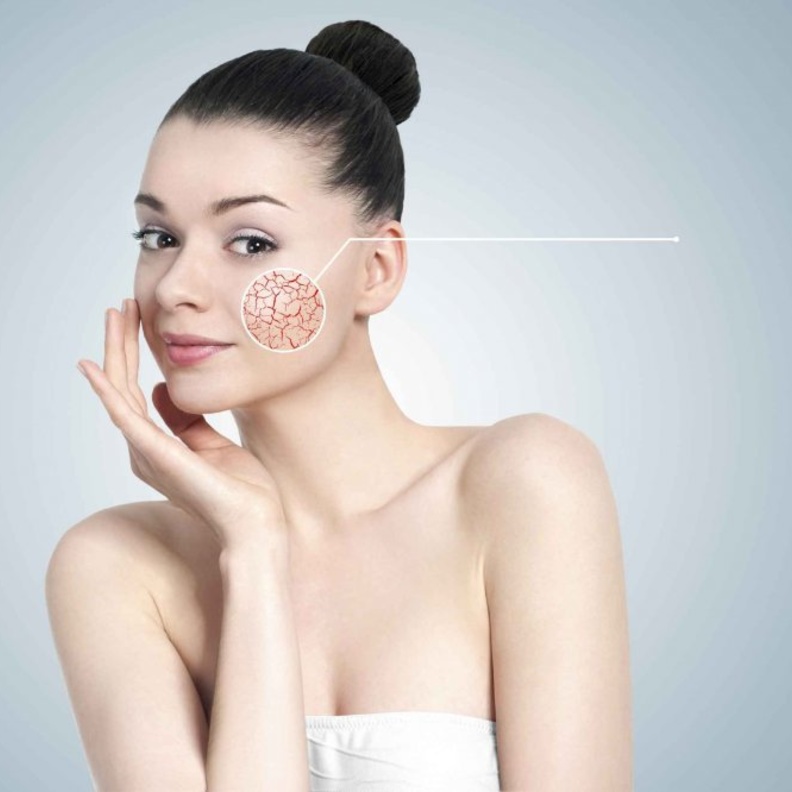 خلطات طبييعية لازالة اثار الحروق القديمة