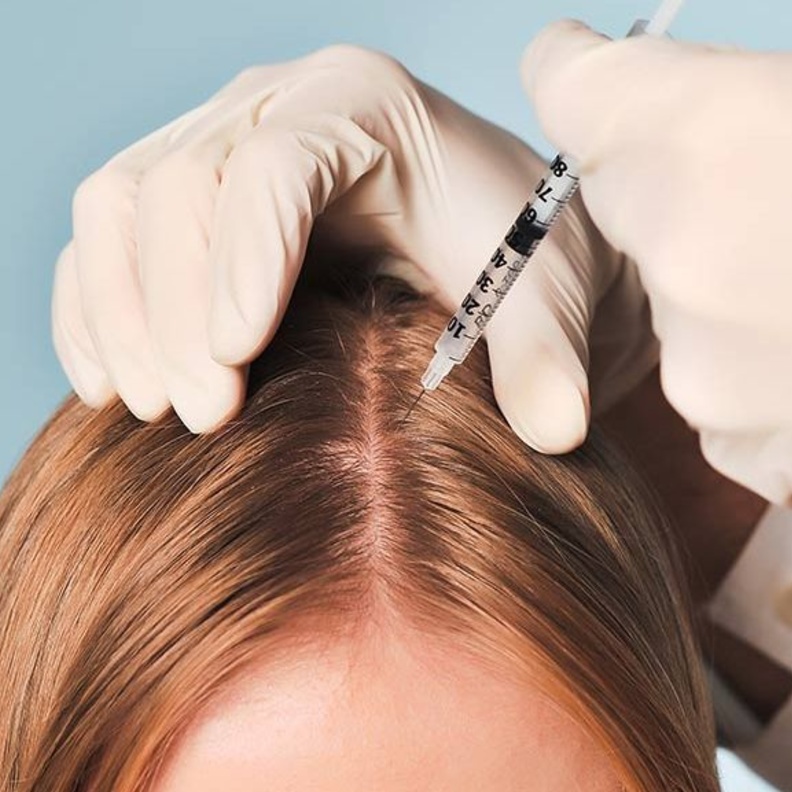 فيلر الشعر هو أحدث شكل من أشكال العناية بالشعر