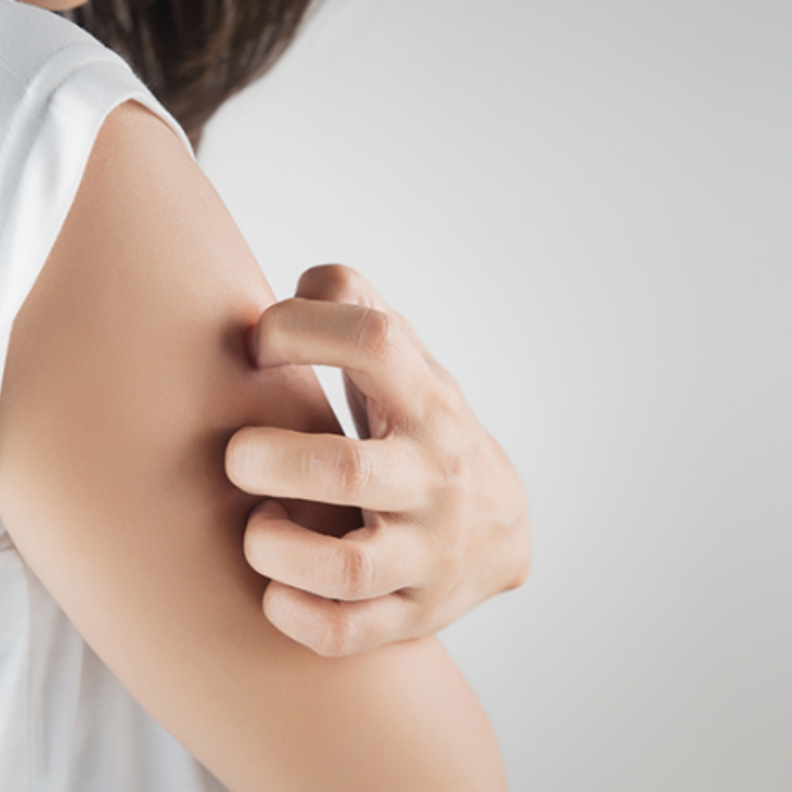  الحكة الجلدية من أعراض الصدفية التي تزداد في الصيف