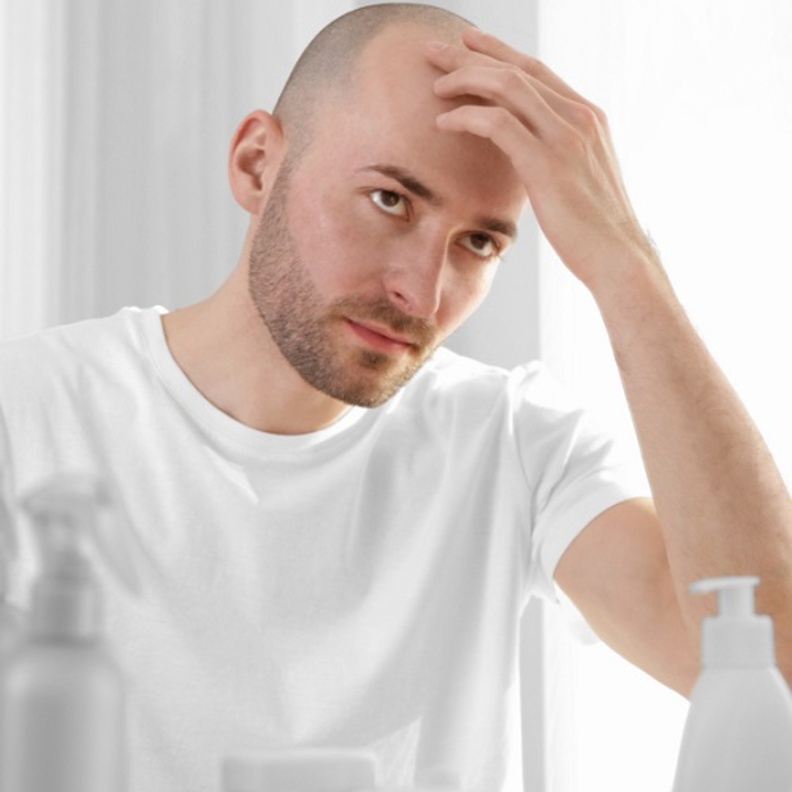 أسباب تساقط الشعر عند الرجال