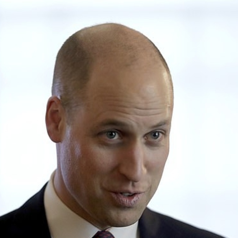 إصابة الأمير وليام بالصلع سببت أزمة لمصممي العملات التذكارية التي تحمل صوره