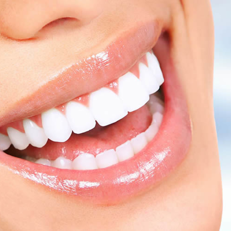 إليك أهم ما يميز تلبيس أسنان الزيركون