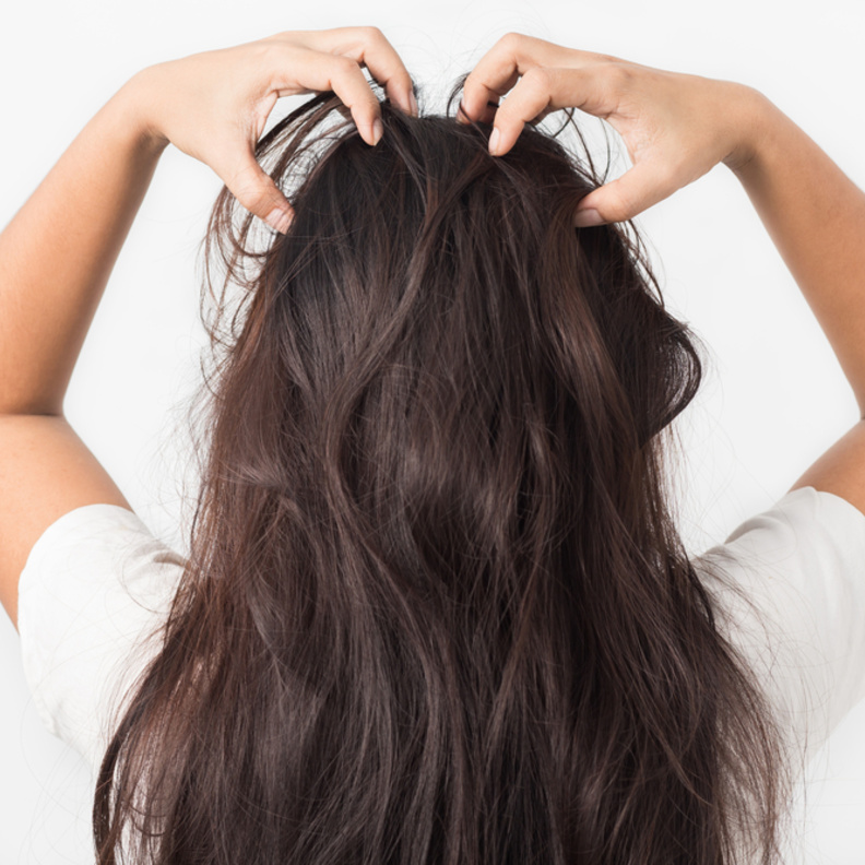 تجنبي تراكم الجلد الميتة لتجنب حكة فروة الرأس