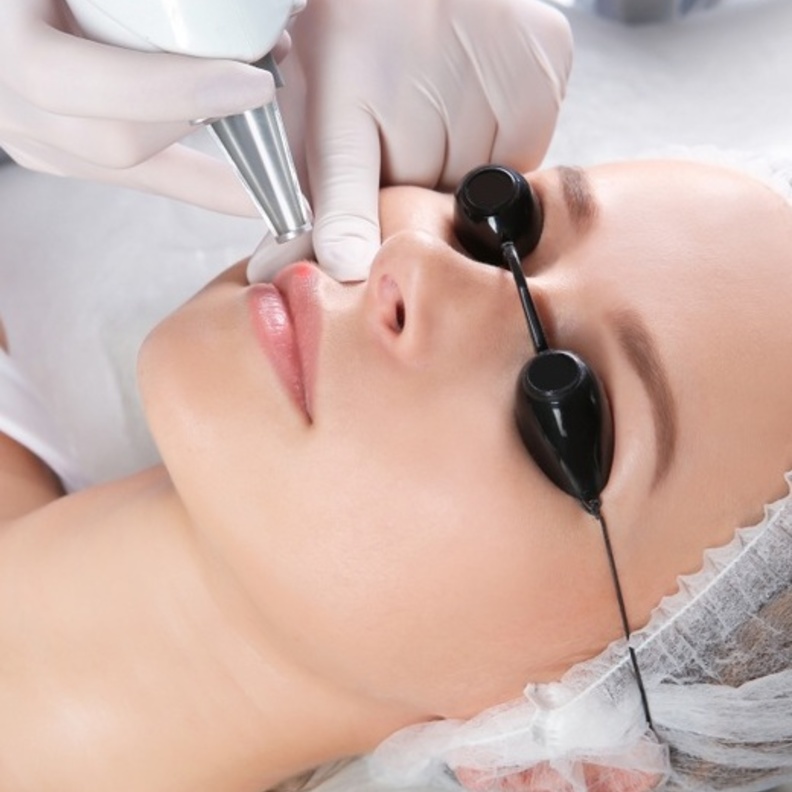  توريد الشفايف بالليزر