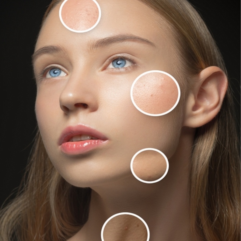  البشرة الدهنية تساعد على تأخير علامات الشيخوخة