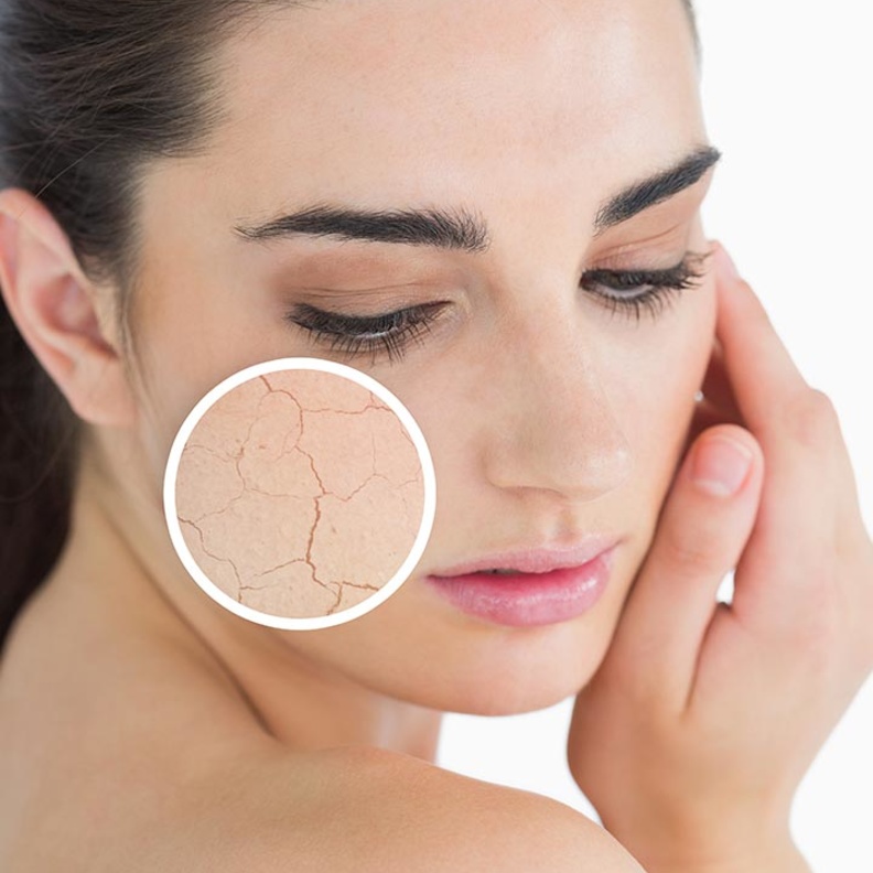 استخدمي زيوت البشرة لنعومة فورية والحصول على عناصر غذائية