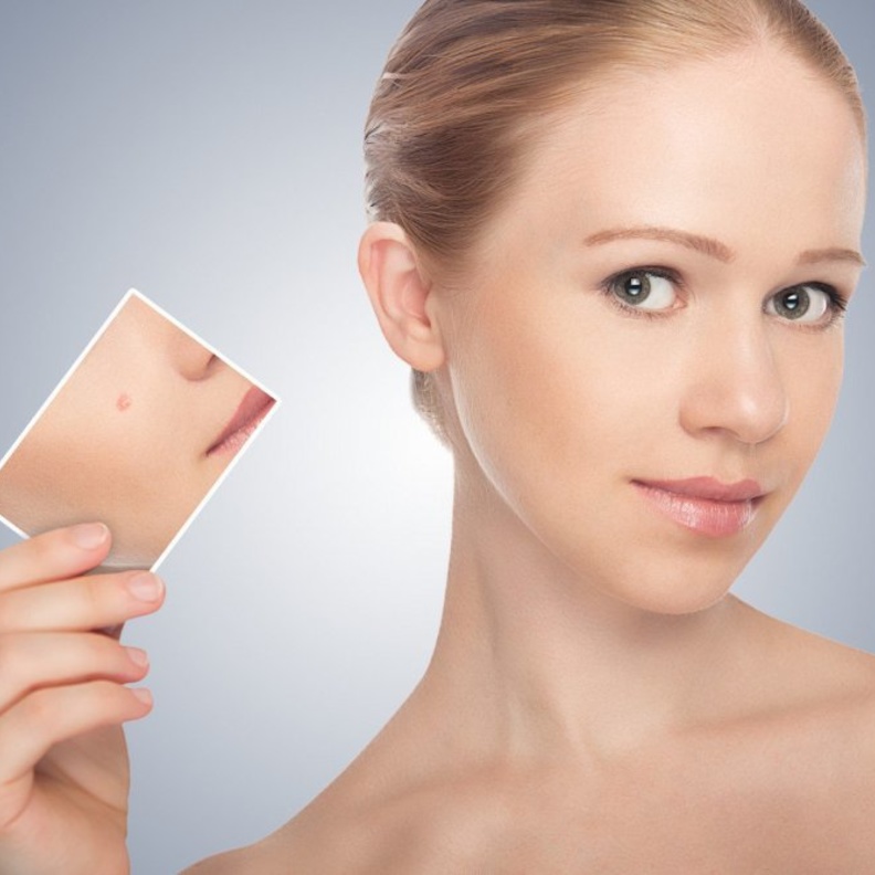 فوائد خل التفاح للبشرة وكيفية استخدامه