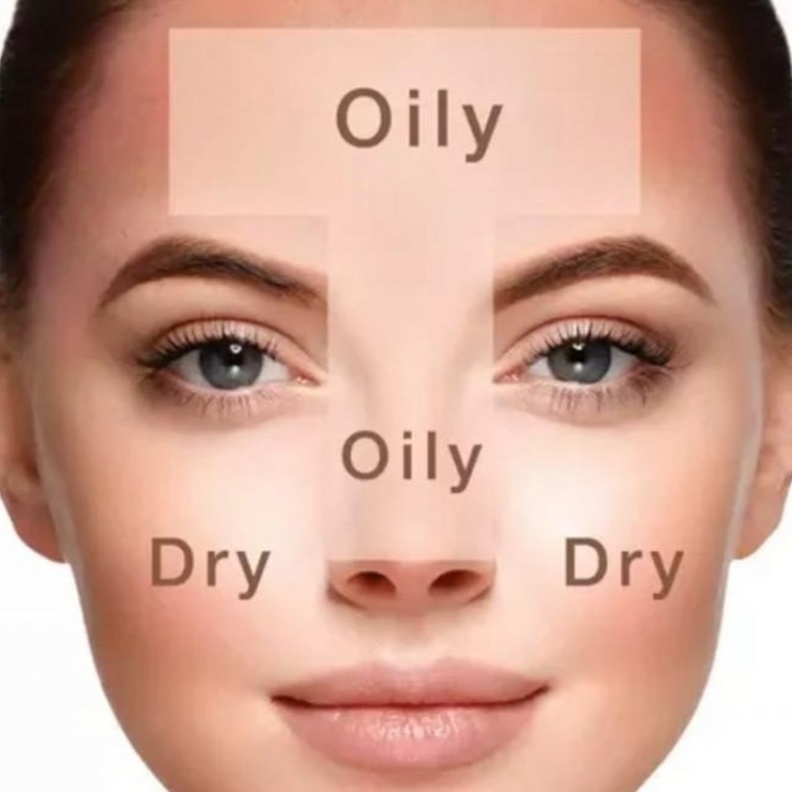 أنواع متعددة من البشرة تجمع نفس مشكلات حب الشباب والبثور فانتهي لذلك