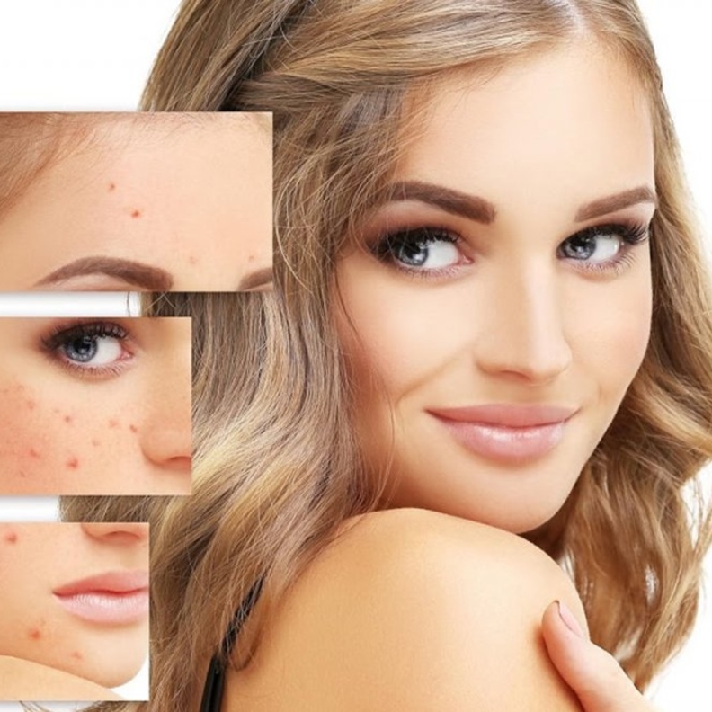 فوائد ماء البحر للبشرة الدهنية وطرق استخدامها