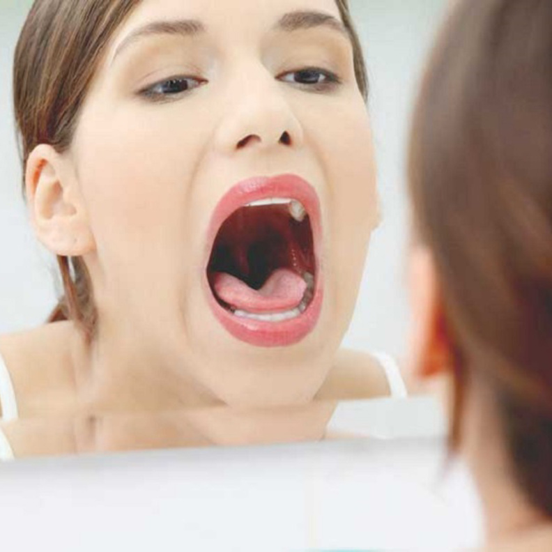 اللسان الجغرافي حالة صحية ليس لها مسبب مرضي