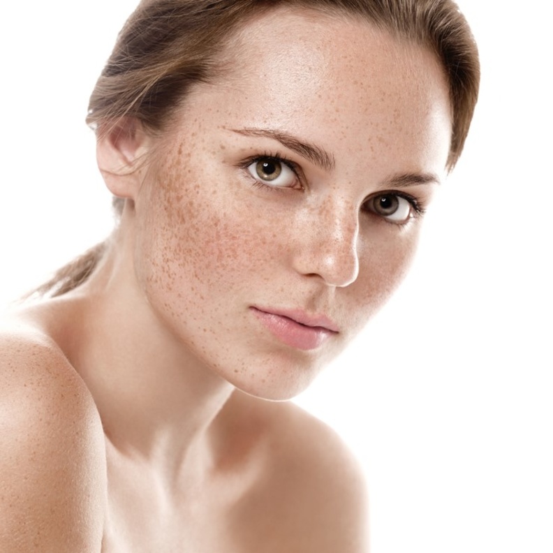 تعرفي على وصفات طبيعية للتخلص من الكلف والنمش