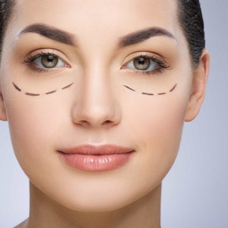 تعرفي على ماسكات لازالة الهالات السوداء تحت العين بطريقة سريعة