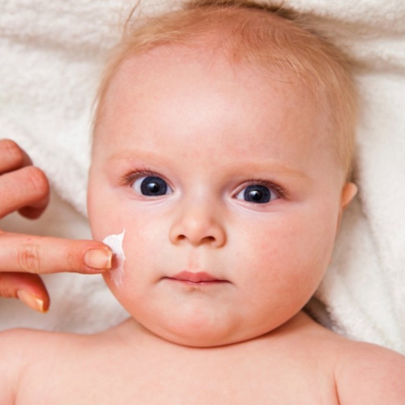اسباب اكزيما الرضع