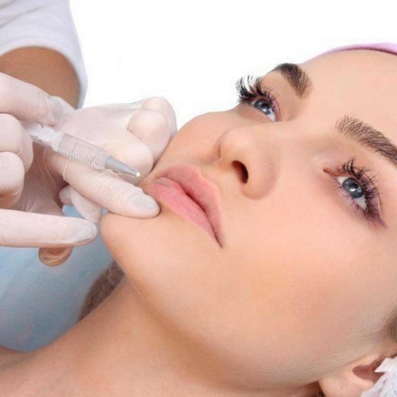 نفخ الشفايف