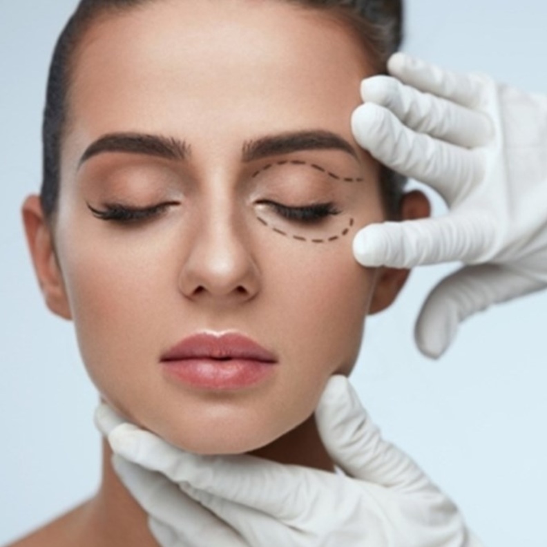 تجاعيد العين