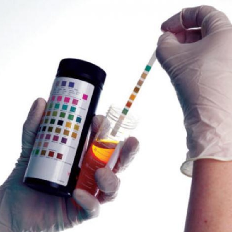  ارتفاع البوتين في البول دليل على الأمراض