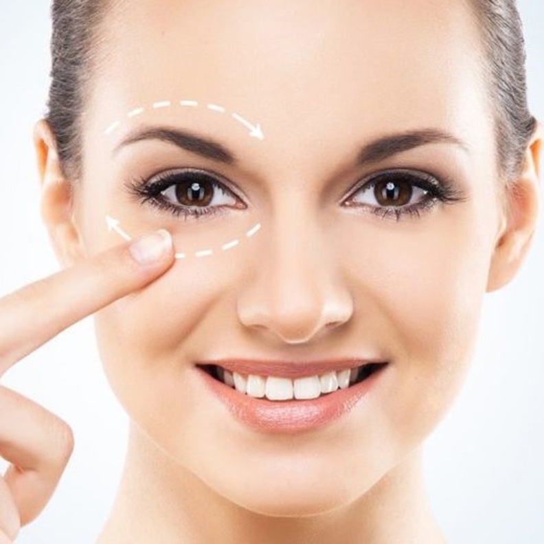 الهالات السوداء