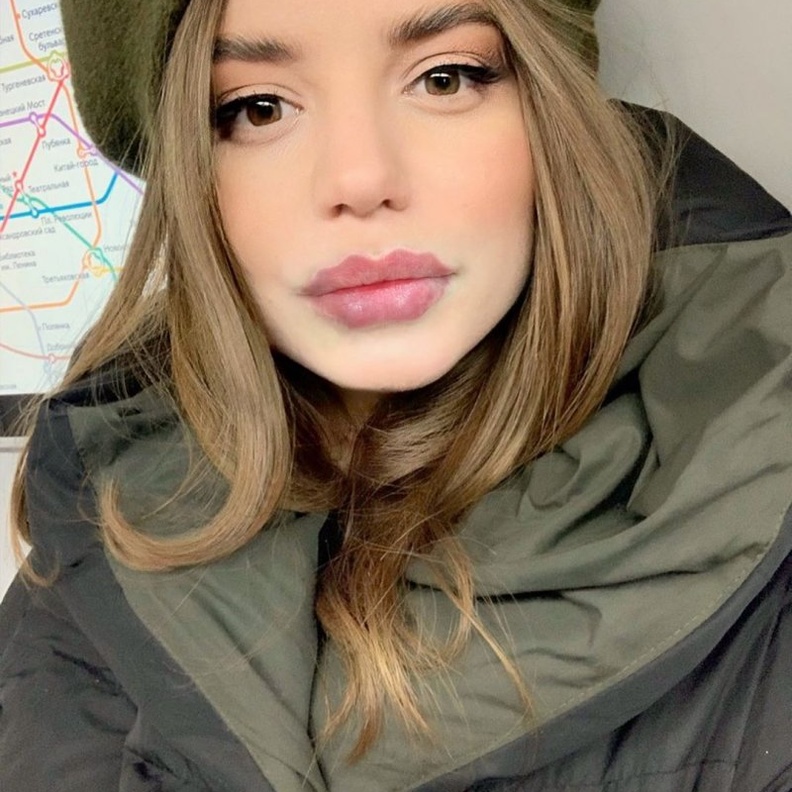 شفاه الأخطبوط تشمل إدخال حشو في الشفة الخارجية لإنشاء تأثير موجة عبر الشفتين